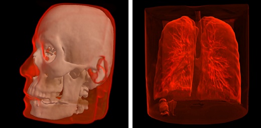 ../_images/mri-volume.jpg